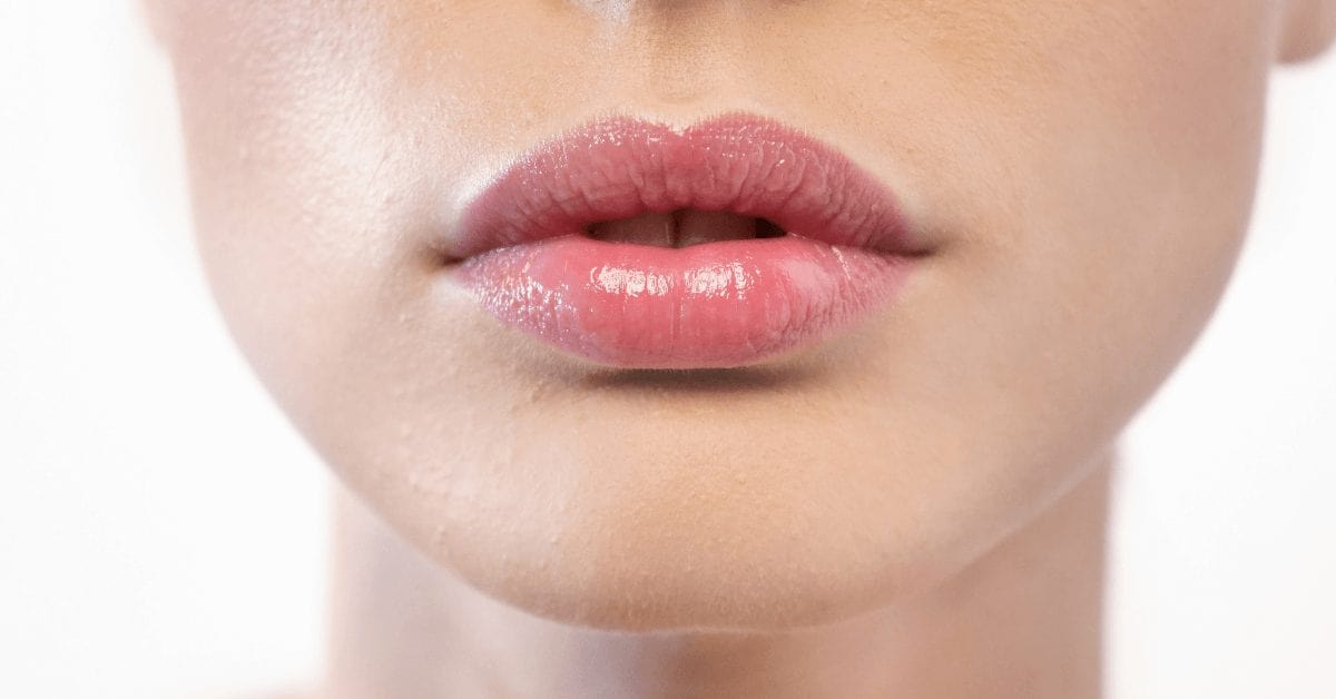 Lip Injections: Its Benefits and The 3 Things You Need to Know